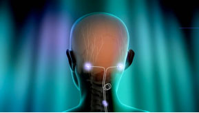migraine nerve simulator