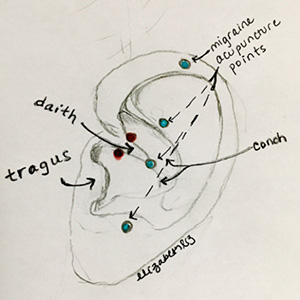Daith piercing sketch with labeled acupuncture points