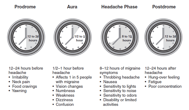 Expert Insights Multiple Auras During a Migraine Attack