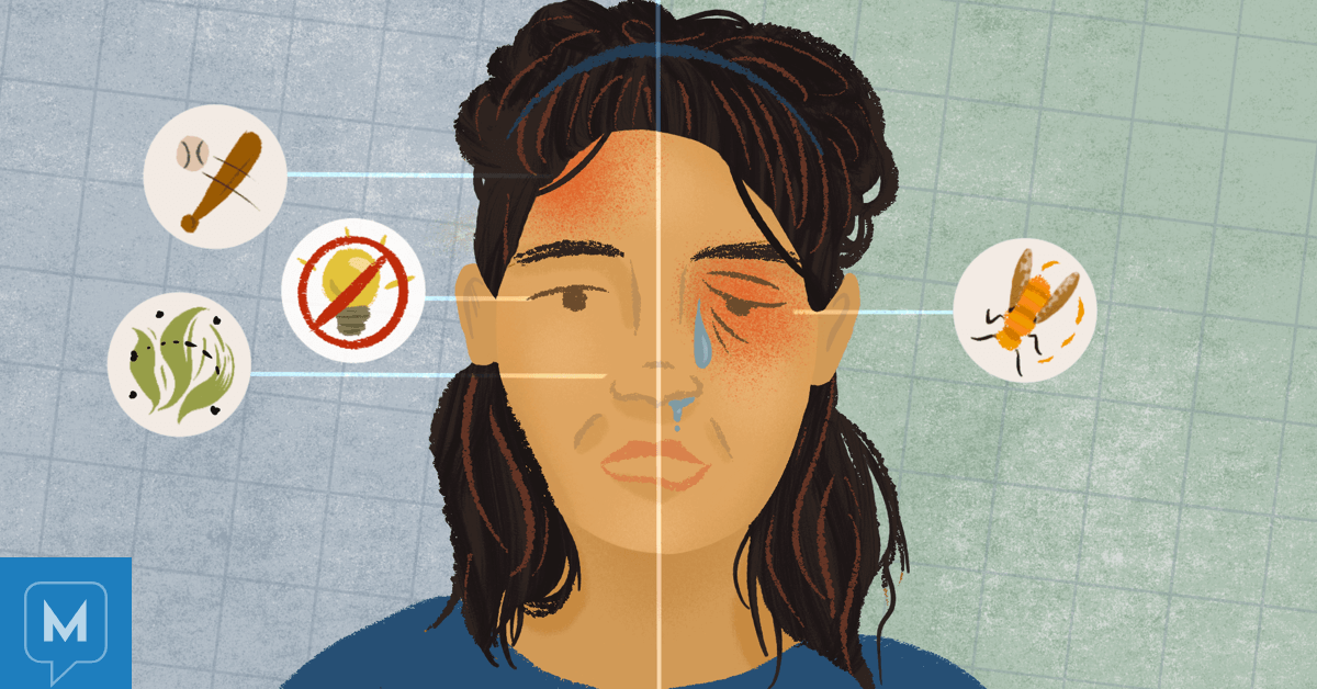 Migraine Vs Cluster Headaches What S The Difference Migraine Vs Cluster Headaches What S The Difference