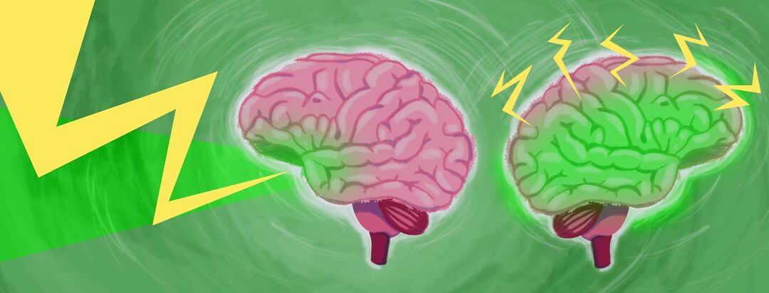 Two brains sit back to back. One has a large lightening bolt that hits an eye socket while the other has many little bolts of pain across half the head.